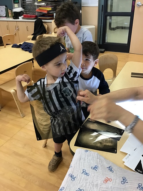 child with an xray on him