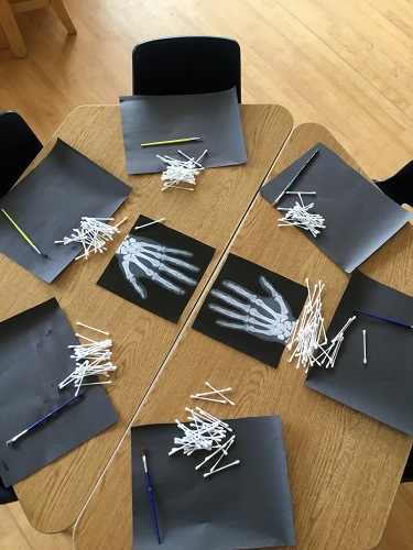 provocation set out on table. Black paper with white qtips.  Images of black and white xray of hands